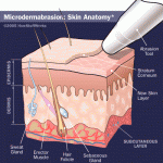 microdermabrasion and skin